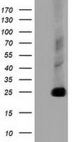 CLPP Antibody in Western Blot (WB)