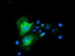 CLPP Antibody in Immunocytochemistry (ICC/IF)