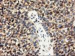 CLPP Antibody in Immunohistochemistry (Paraffin) (IHC (P))