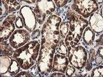 CLPP Antibody in Immunohistochemistry (Paraffin) (IHC (P))