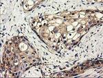 CLPP Antibody in Immunohistochemistry (Paraffin) (IHC (P))