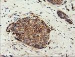 CLPP Antibody in Immunohistochemistry (Paraffin) (IHC (P))