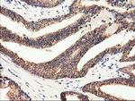 CLPP Antibody in Immunohistochemistry (Paraffin) (IHC (P))