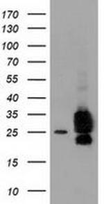 CLPP Antibody in Western Blot (WB)