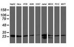 CLPP Antibody in Western Blot (WB)