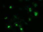 ZIM2 Antibody in Immunocytochemistry (ICC/IF)