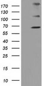 ZIM2 Antibody in Western Blot (WB)