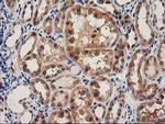 PYCRL Antibody in Immunohistochemistry (Paraffin) (IHC (P))