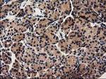 PYCRL Antibody in Immunohistochemistry (Paraffin) (IHC (P))