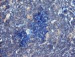 DUPD1 Antibody in Immunohistochemistry (Paraffin) (IHC (P))