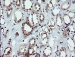 DUPD1 Antibody in Immunohistochemistry (Paraffin) (IHC (P))