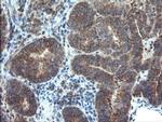 DUPD1 Antibody in Immunohistochemistry (Paraffin) (IHC (P))