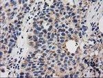 GRHPR Antibody in Immunohistochemistry (Paraffin) (IHC (P))