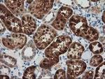 GRHPR Antibody in Immunohistochemistry (Paraffin) (IHC (P))