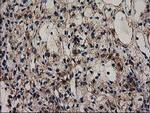 GRHPR Antibody in Immunohistochemistry (Paraffin) (IHC (P))