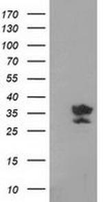 GRHPR Antibody in Western Blot (WB)