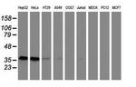 GRHPR Antibody in Western Blot (WB)