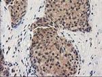 GRHPR Antibody in Immunohistochemistry (Paraffin) (IHC (P))