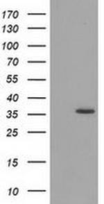 GRHPR Antibody in Western Blot (WB)