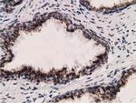 LMAN1 Antibody in Immunohistochemistry (Paraffin) (IHC (P))