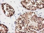 GALE Antibody in Immunohistochemistry (Paraffin) (IHC (P))