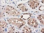 GALE Antibody in Immunohistochemistry (Paraffin) (IHC (P))