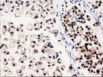 GALE Antibody in Immunohistochemistry (Paraffin) (IHC (P))