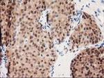 GALE Antibody in Immunohistochemistry (Paraffin) (IHC (P))