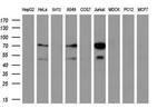 GCKR Antibody in Western Blot (WB)