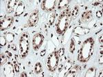 SAMHD1 Antibody in Immunohistochemistry (Paraffin) (IHC (P))