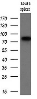 SAMHD1 Antibody in Western Blot (WB)