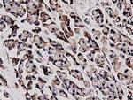 HDAC6 Antibody in Immunohistochemistry (Paraffin) (IHC (P))