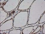 HDAC6 Antibody in Immunohistochemistry (Paraffin) (IHC (P))