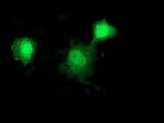 HSP40 Antibody in Immunocytochemistry (ICC/IF)