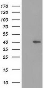 HSP40 Antibody in Western Blot (WB)