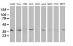 HSP40 Antibody in Western Blot (WB)