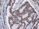 CTDSP1 Antibody in Immunohistochemistry (Paraffin) (IHC (P))