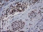 CTDSP1 Antibody in Immunohistochemistry (Paraffin) (IHC (P))