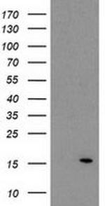 ATP6V1F Antibody in Western Blot (WB)