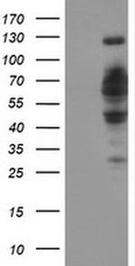 DCLRE1B Antibody in Western Blot (WB)