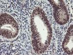 ZFP36 Antibody in Immunohistochemistry (Paraffin) (IHC (P))