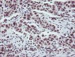 ZFP36 Antibody in Immunohistochemistry (Paraffin) (IHC (P))