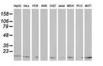 ATP6V1F Antibody in Western Blot (WB)