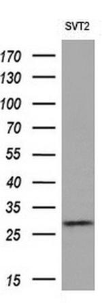 eIF4E2 Antibody in Western Blot (WB)