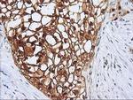 SERPINB4 Antibody in Immunohistochemistry (Paraffin) (IHC (P))