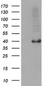 SERPINB4 Antibody in Western Blot (WB)