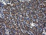 RASSF1 Antibody in Immunohistochemistry (Paraffin) (IHC (P))