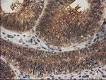 RASSF1 Antibody in Immunohistochemistry (Paraffin) (IHC (P))