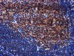 PIH1D2 Antibody in Immunohistochemistry (Paraffin) (IHC (P))