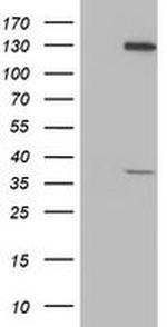 PIH1D2 Antibody in Western Blot (WB)